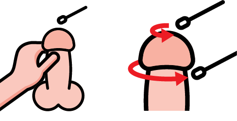 एसटीआई किट 65 जानकारी 06