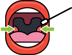 एसटीआई किट 59 जानकारी 07